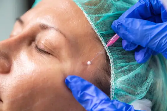 Skin procedure